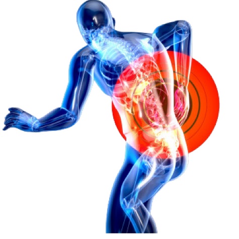 Lombalgie : causes, symptômes et solutions naturelles pour soulager votre mal de dos